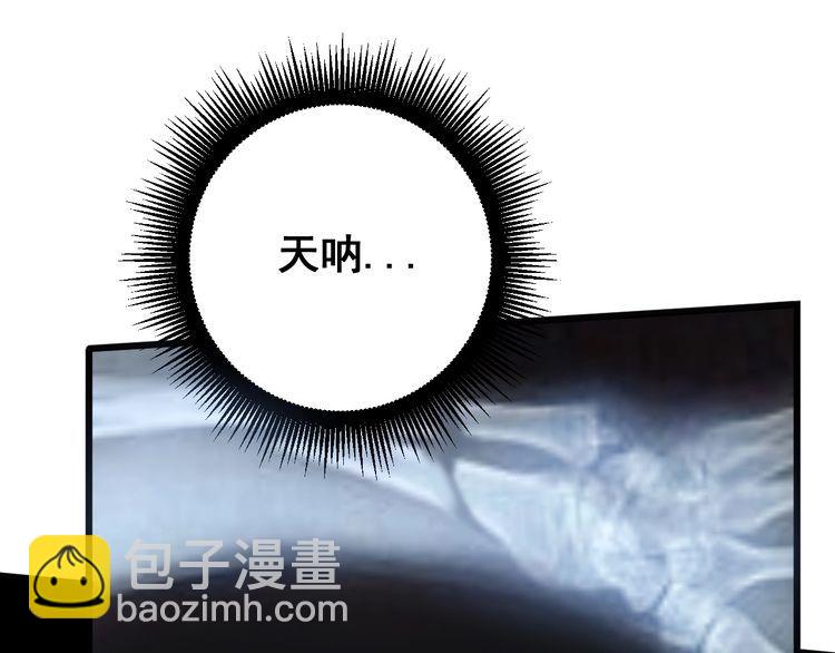 第143话 凯氏骨病117