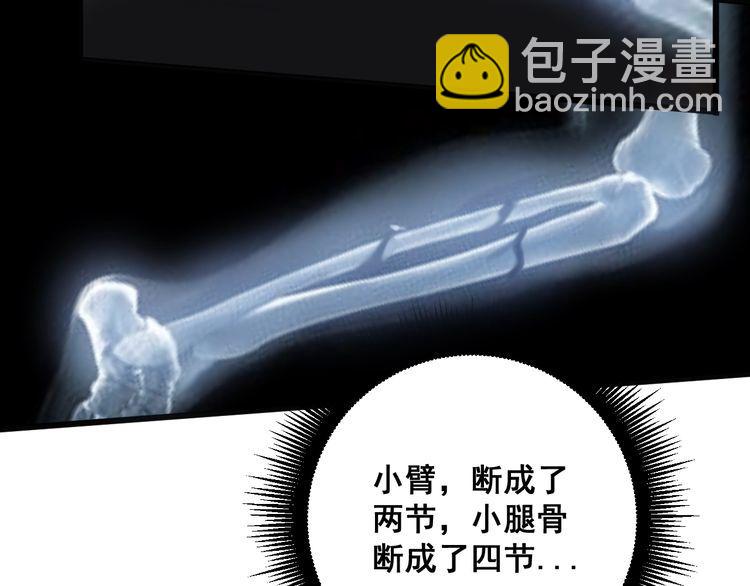 第143话 凯氏骨病118