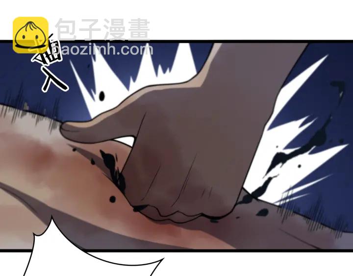 第43话 徒手止血2.0（上）99