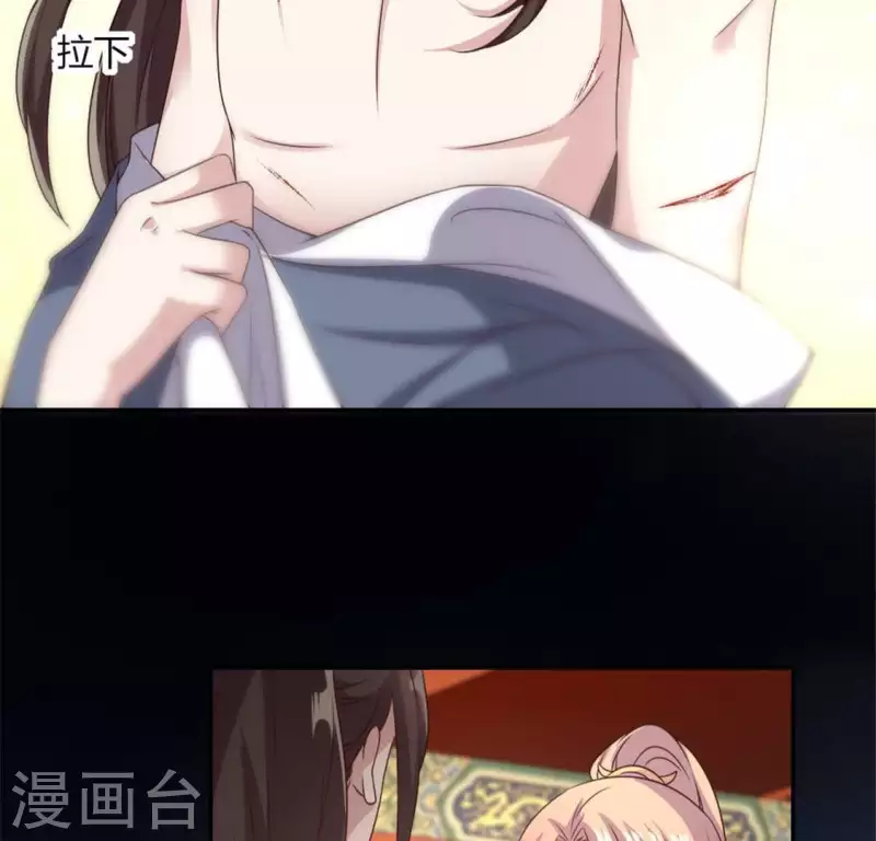 第83话 伤痕28