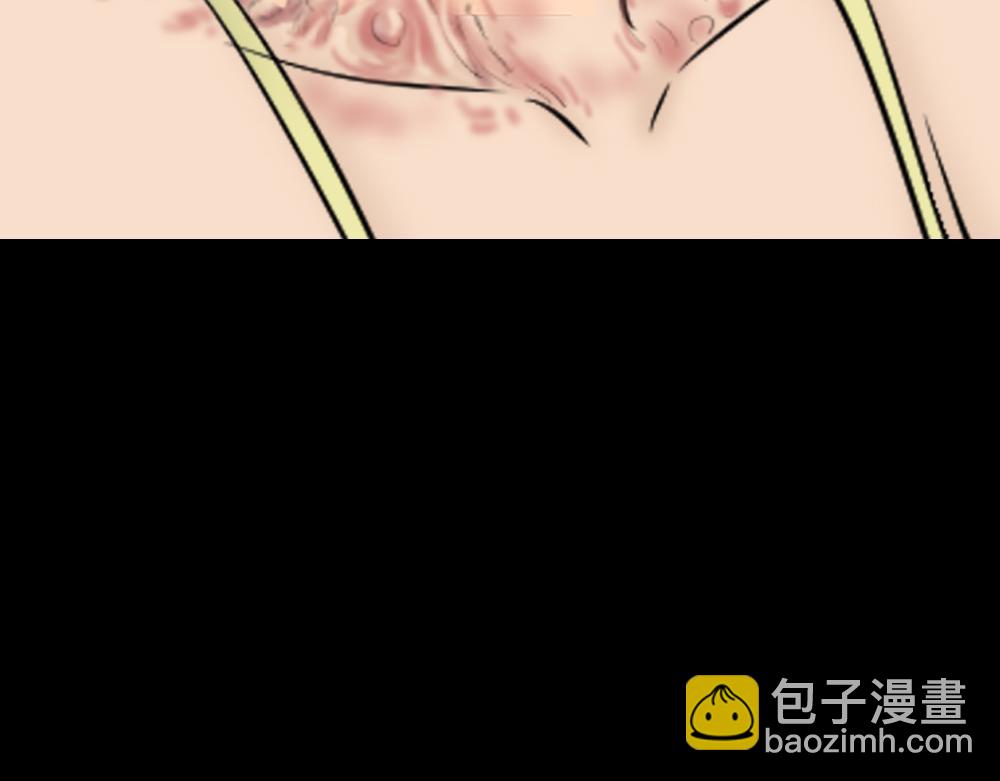 毁容相机182
