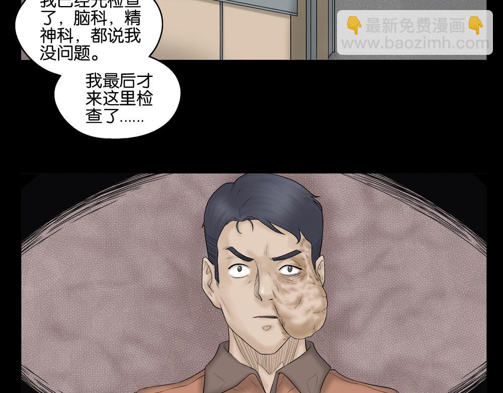 奇异的瘤45