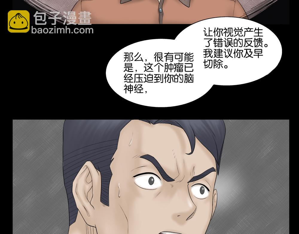奇异的瘤50
