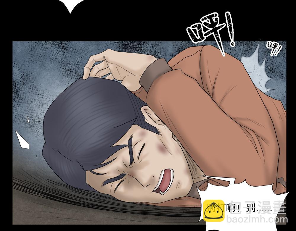 奇异的瘤70