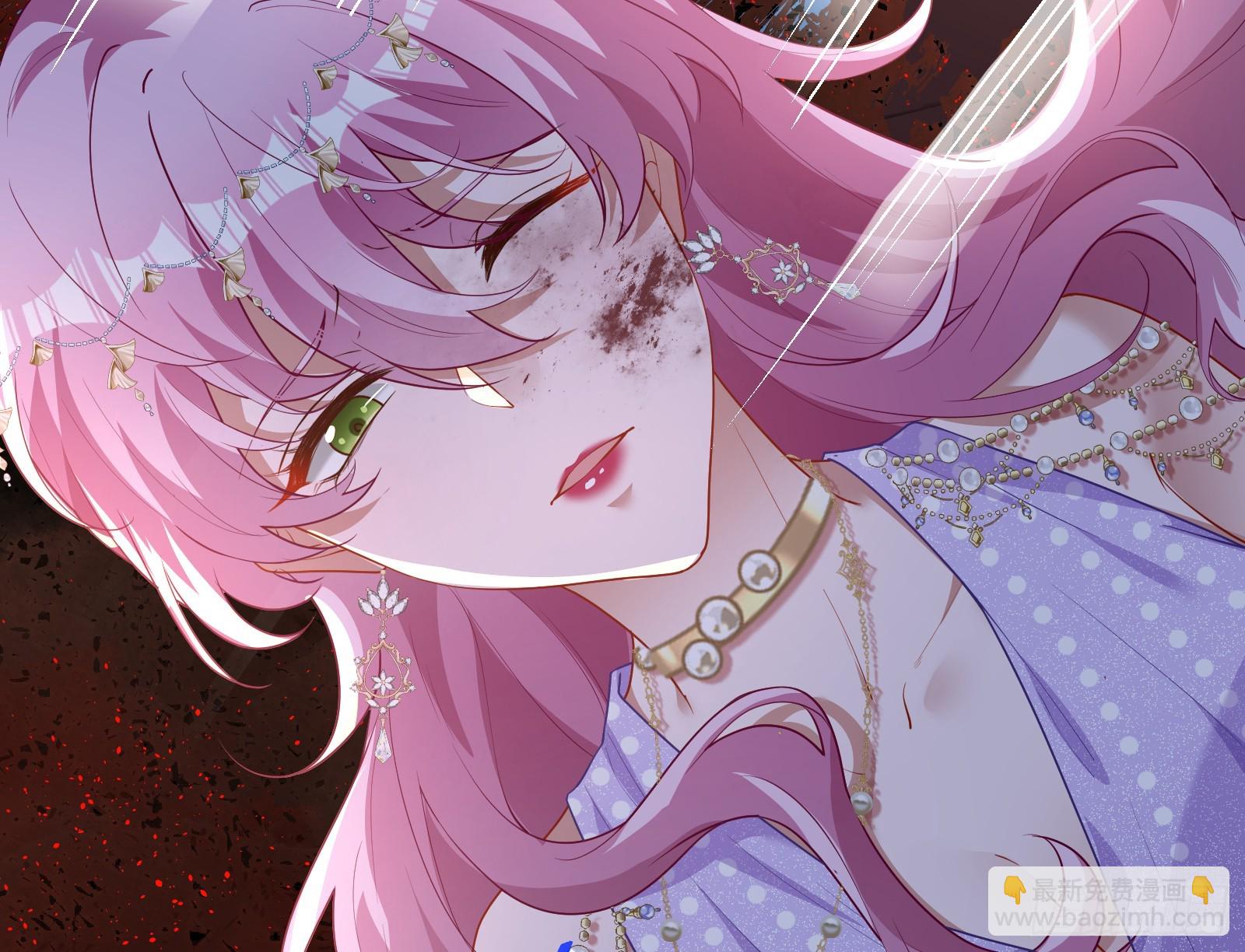 夏夏受伤37