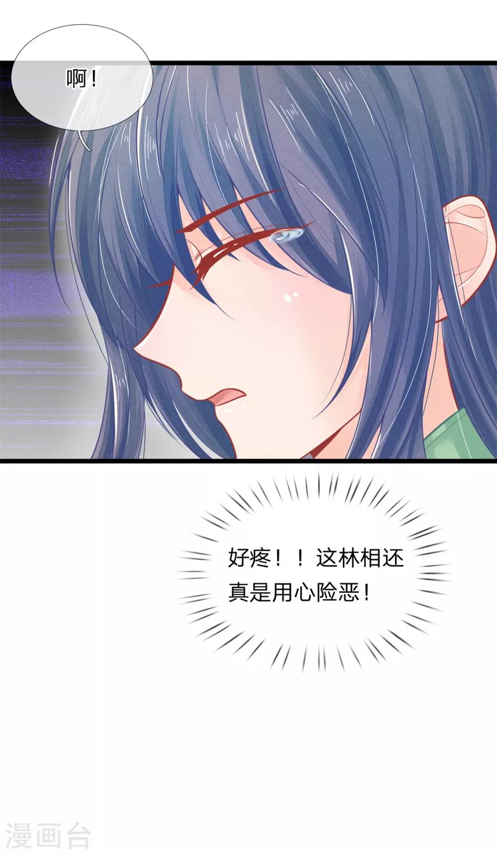 第82话 保命要紧19
