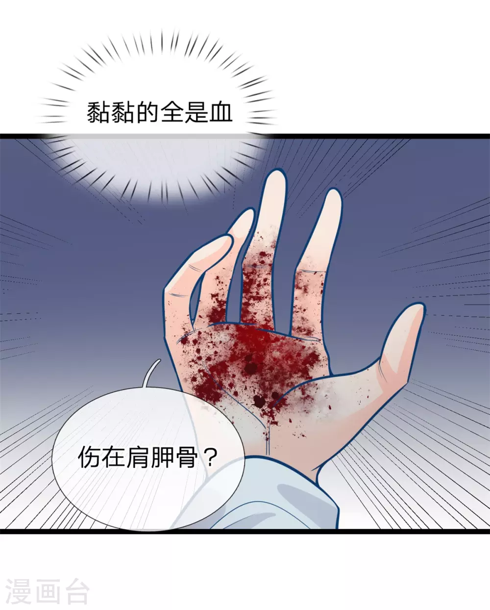 第161话 受伤，咱俩不熟17
