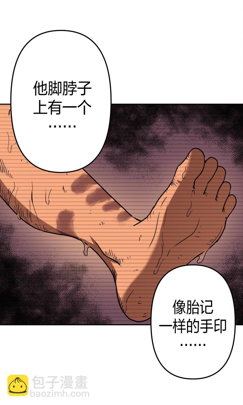 037 神秘的胎记18